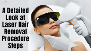 laser hair removal procedure steps